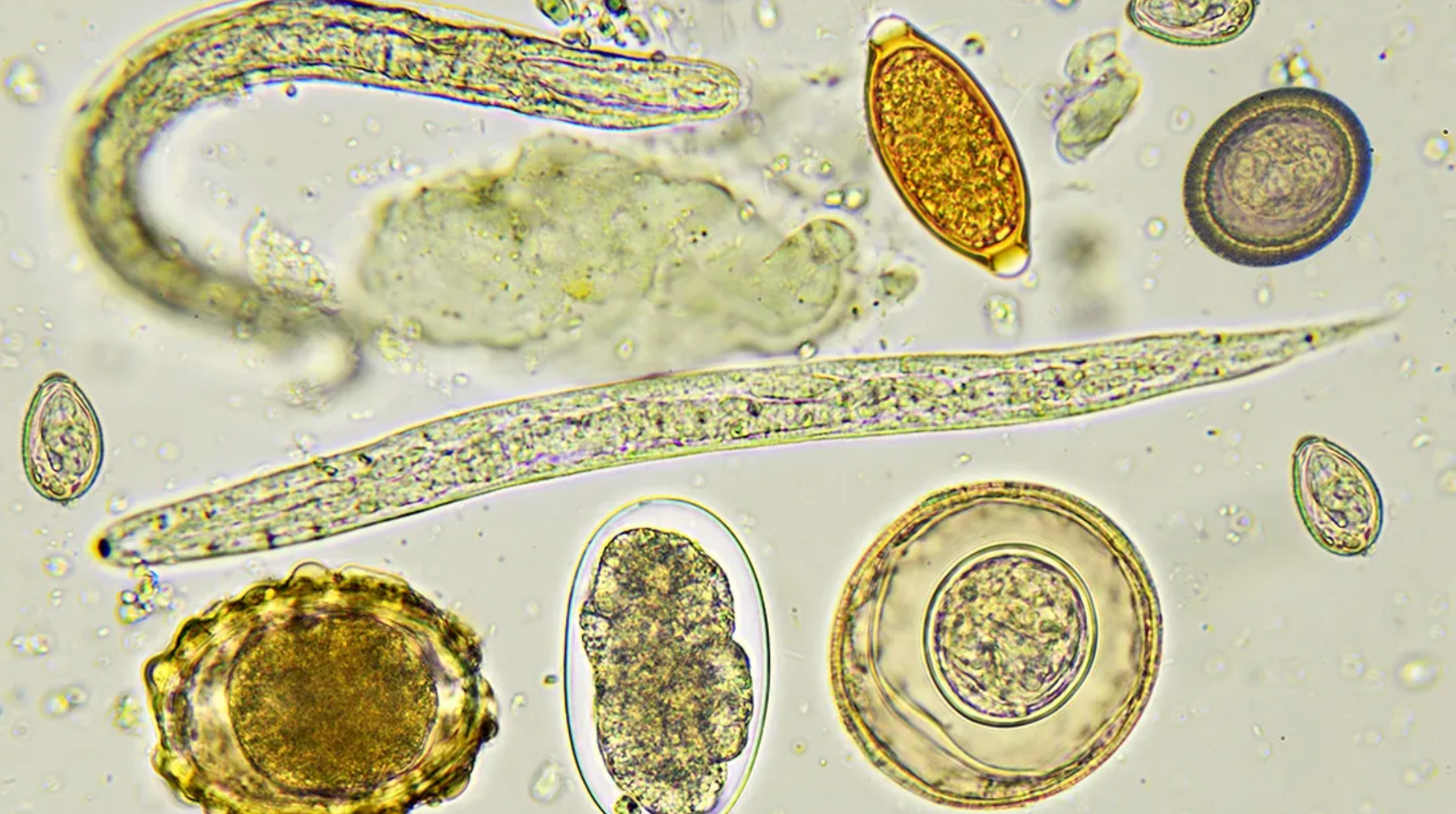 Parasites, Anxiety, Depression, and Brain Fog: The Nervous System Connection